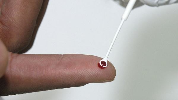 Fiji declara emergência nacional por HIV com 1 caso a cada 60 pessoas